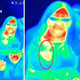 Imagen para el artículo titulado Una mancha en la imagen de una atracción con cámaras térmicas detecta un cáncer a una mujer